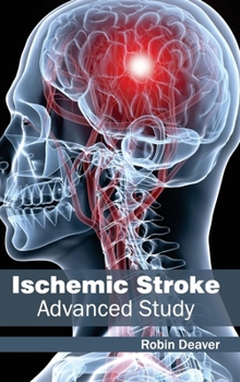 Hardcover Ischemic Stroke: Advanced Study Book