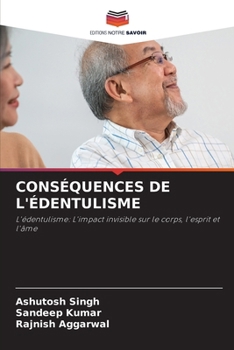 Paperback Conséquences de l'Édentulisme [French] Book