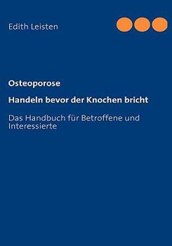 Paperback Osteoporose: Handeln bevor der Knochen bricht [German] Book