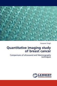 Paperback Quantitative imaging study of breast cancer Book