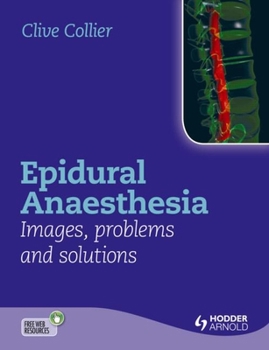 Hardcover Epidural Anaesthesia: Images, Problems and Solutions Book