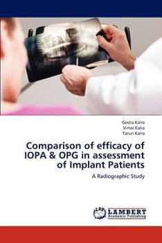 Paperback Comparison of efficacy of IOPA & OPG in assessment of Implant Patients Book