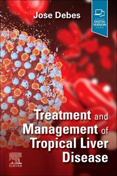 Paperback Treatment and Management of Tropical Liver Disease Book