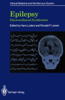 Paperback Epilepsy: Electroclinical Syndromes Book