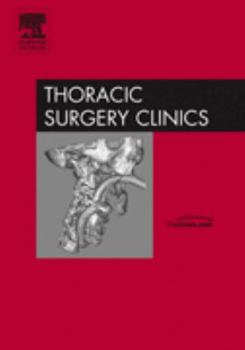 Hardcover Preoperative Preparation of Patients for Thoracic Surgery, an Issue of Thoracic Surgery Clinics: Volume 15-2 Book