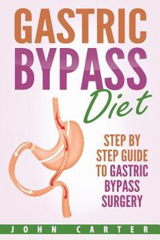 Paperback Gastric Bypass Diet: Step By Step Guide to Gastric Bypass Surgery Book