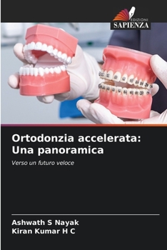 Paperback Ortodonzia accelerata: Una panoramica [Italian] Book