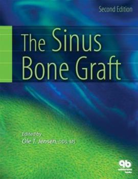 Hardcover Sinus Bone Graft Book