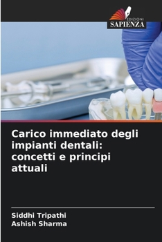 Carico immediato degli impianti dentali: concetti e principi attuali (Italian Edition)