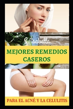 Paperback Mejores Remedios Caseros: para el acn? y la celulitis [Spanish] Book