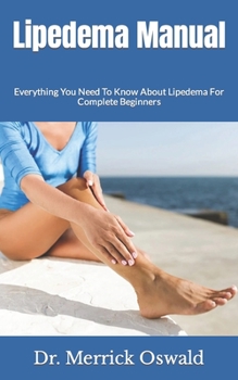 Paperback Lipedema Manual: Everything You Need To Know About Lipedema For Complete Beginners Book