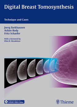 Hardcover Digital Breast Tomosynthesis: Technique and Cases Book