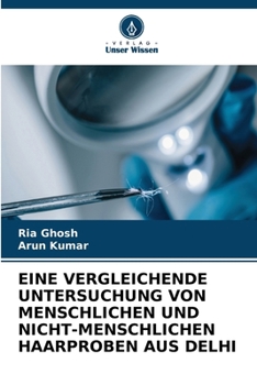 Eine Vergleichende Untersuchung Von Menschlichen Und Nicht-Menschlichen Haarproben Aus Delhi (German Edition)