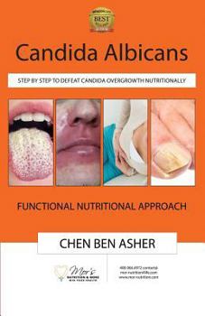 Paperback Candida Albicans: Step by Step to Defeat Candida Overgrowth Nutritionally Book