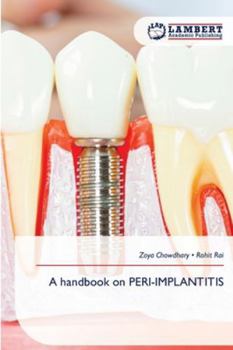 A handbook on PERI-IMPLANTITIS