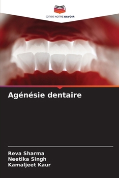 Agénésie dentaire (French Edition)
