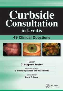 Paperback Curbside Consultation in Uveitis: 49 Clinical Questions Book