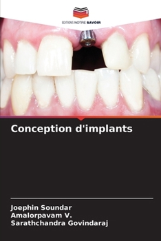 Paperback Conception d'implants [French] Book