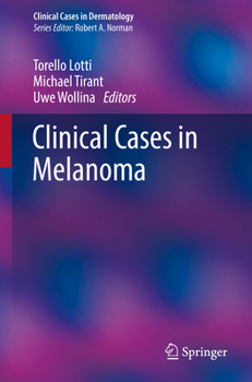 Paperback Clinical Cases in Melanoma Book