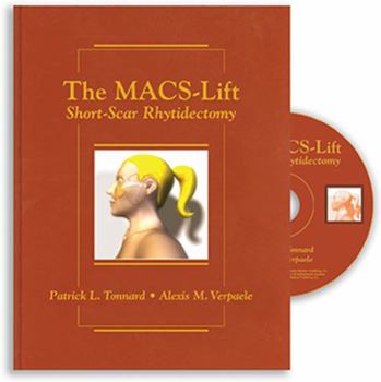Hardcover The Macs-Lift: Short-Scar Rhytidectomy Book