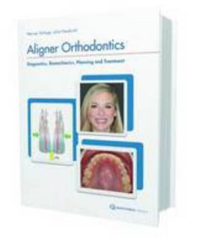 Hardcover Aligner Orthodontics: Diagnostics, Biomechanics, Planning, and Treatment Book