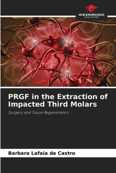 Paperback PRGF in the Extraction of Impacted Third Molars Book