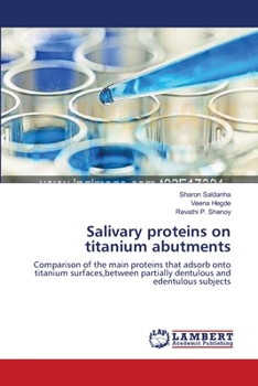Paperback Salivary proteins on titanium abutments Book