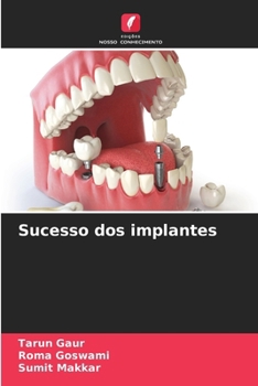 Paperback Sucesso dos implantes [Portuguese] Book