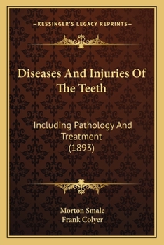 Diseases And Injuries Of The Teeth: Including Pathology And Treatment