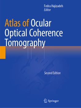 Paperback Atlas of Ocular Optical Coherence Tomography Book