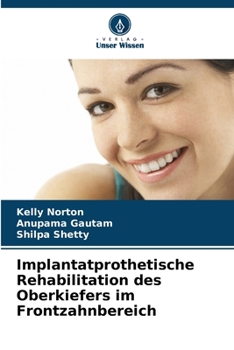 Paperback Implantatprothetische Rehabilitation des Oberkiefers im Frontzahnbereich [German] Book