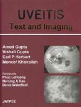 Hardcover Uveitis: Text and Imaging Book