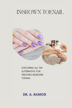 Paperback Ingrown Toenail: Exploring All the Alternative for Treating Ingrown Toenail Book