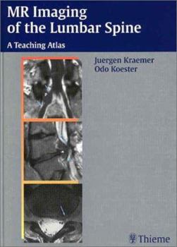 Hardcover Mr Imaging of the Lumbar Spine: A Teaching Atlas Book