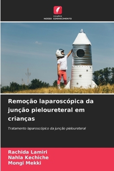 Paperback Remoção laparoscópica da junção pieloureteral em crianças [Portuguese] Book