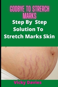 Paperback Goodbye To Stretch Marks: Step by Step Solution to Stretch Mark Free Skin Book