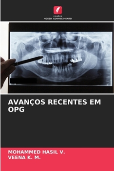 Paperback Avanços Recentes Em Opg [Portuguese] Book