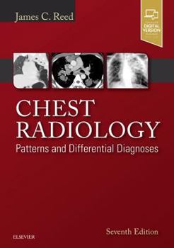 Hardcover Chest Radiology: Patterns and Differential Diagnoses Book