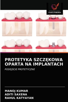 Paperback Protetyka Szcz&#280;kowa Oparta Na Implantach [Polish] Book