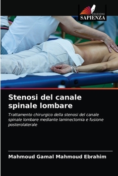 Paperback Stenosi del canale spinale lombare [Italian] Book