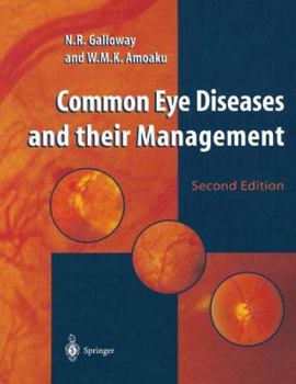 Paperback Common Eye Diseases and Their Management Book