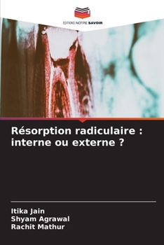 Paperback Résorption radiculaire: interne ou externe ? [French] Book