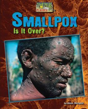 Library Binding Smallpox: Is It Over? Book