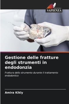 Paperback Gestione delle fratture degli strumenti in endodonzia [Italian] Book