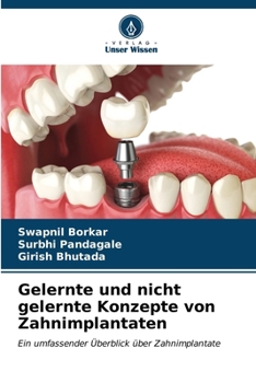 Paperback Gelernte und nicht gelernte Konzepte von Zahnimplantaten [German] Book