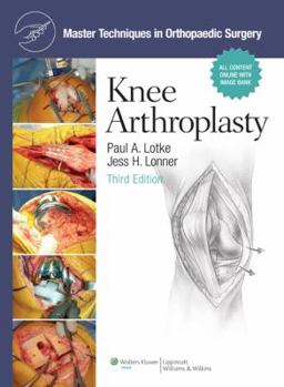 Hardcover Master Techniques in Orthopaedic Surgery: Knee Arthroplasty [With Access Code] Book