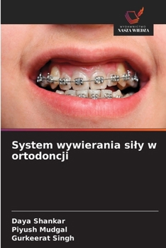 Paperback System wywierania sily w ortodoncji [Polish] Book
