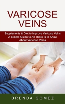 Paperback Varicose Veins: Supplements & Diet to Improve Varicose Veins (A Simple Guide to All There Is to Know About Varicose Veins) Book
