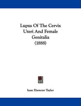 Paperback Lupus Of The Cervix Uteri And Female Genitalia (1888) Book