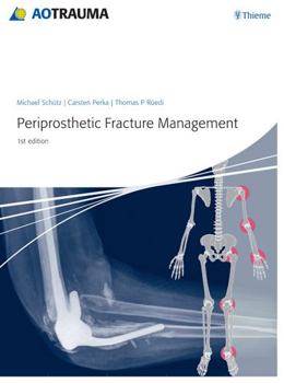 Hardcover Periprosthetic Fracture Management Book